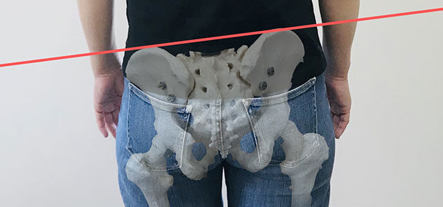骨盤の歪みのイメージ